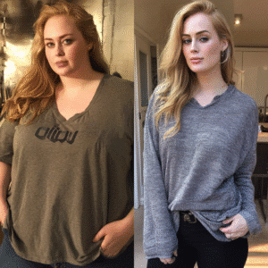 Adele Weight Loss 2020 Did She Have Bariatric Surgery?